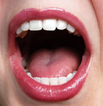 Чистка полости рта